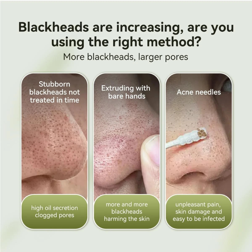 LANBENA 2.0 Blackhead Nose Pore Strips – Deep Cleansing Blackhead Remover (60 Pcs / 1.03 Oz)