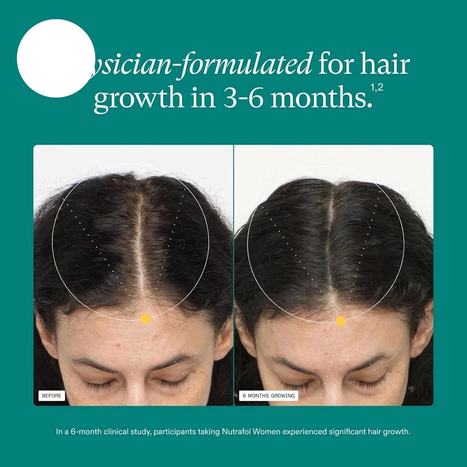 Women's Balance Growth Hair Supplements Premium